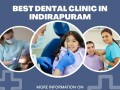 best-dentist-in-indirapuram-small-0