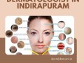 dermatologist-in-indirapuram-small-0