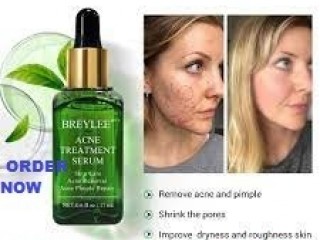 Breylee Acne Treatment Serum Price In Pakistan / 03476961149