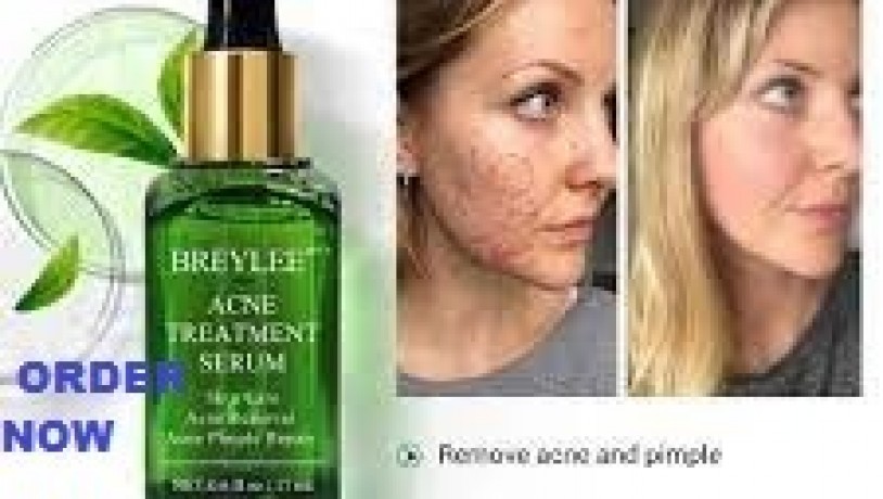 breylee-acne-treatment-serum-price-in-pakistan-03476961149-big-0